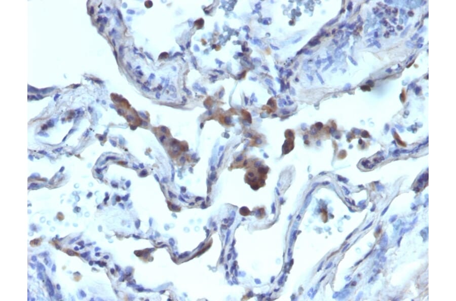 Immunohistochemistry - Anti-AMACR Antibody - BSA and Azide free (A251800) - Antibodies.com