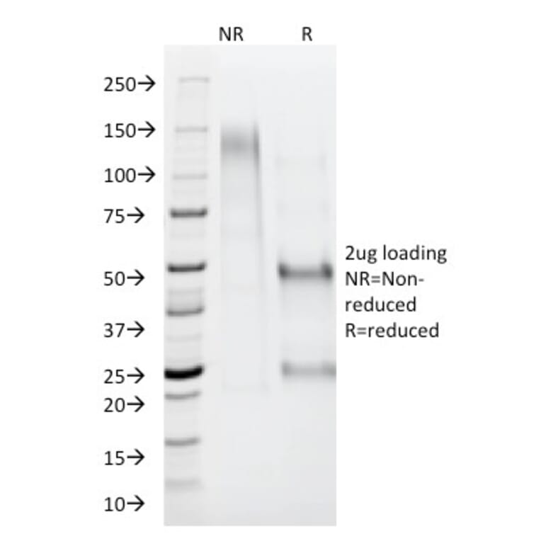 SDS-PAGE - Anti-AMACR Antibody - BSA and Azide free (A251801) - Antibodies.com