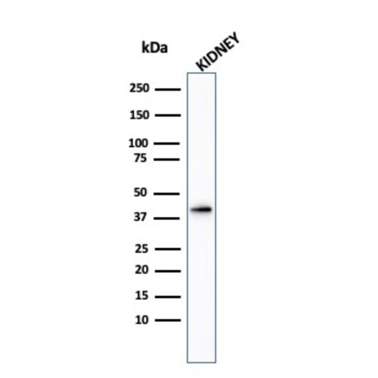 Western Blot - Anti-AMACR Antibody - BSA and Azide free (A251801) - Antibodies.com