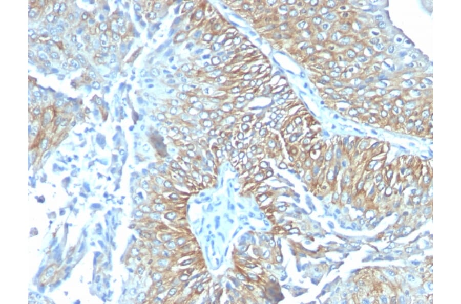 Immunohistochemistry - Anti-TRIM29 Antibody [TRIM29/1041] - BSA and Azide free (A251801) - Antibodies.com