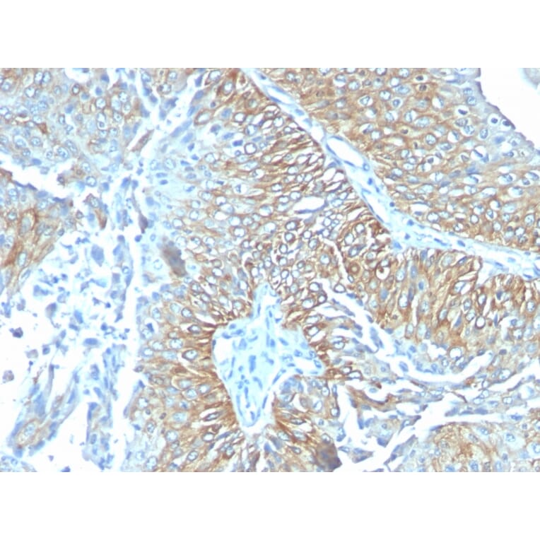 Immunohistochemistry - Anti-TRIM29 Antibody [TRIM29/1041] - BSA and Azide free (A251801) - Antibodies.com