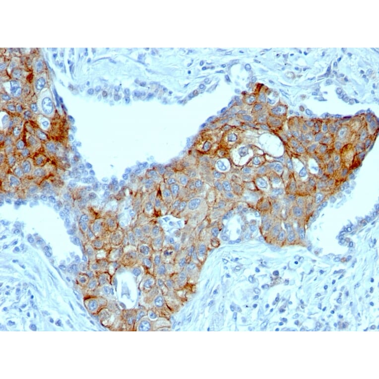 Immunohistochemistry - Anti-TRIM29 Antibody [TRIM29/1041] - BSA and Azide free (A251802) - Antibodies.com