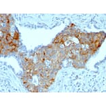 Immunohistochemistry - Anti-TRIM29 Antibody [TRIM29/1041] - BSA and Azide free (A251802) - Antibodies.com