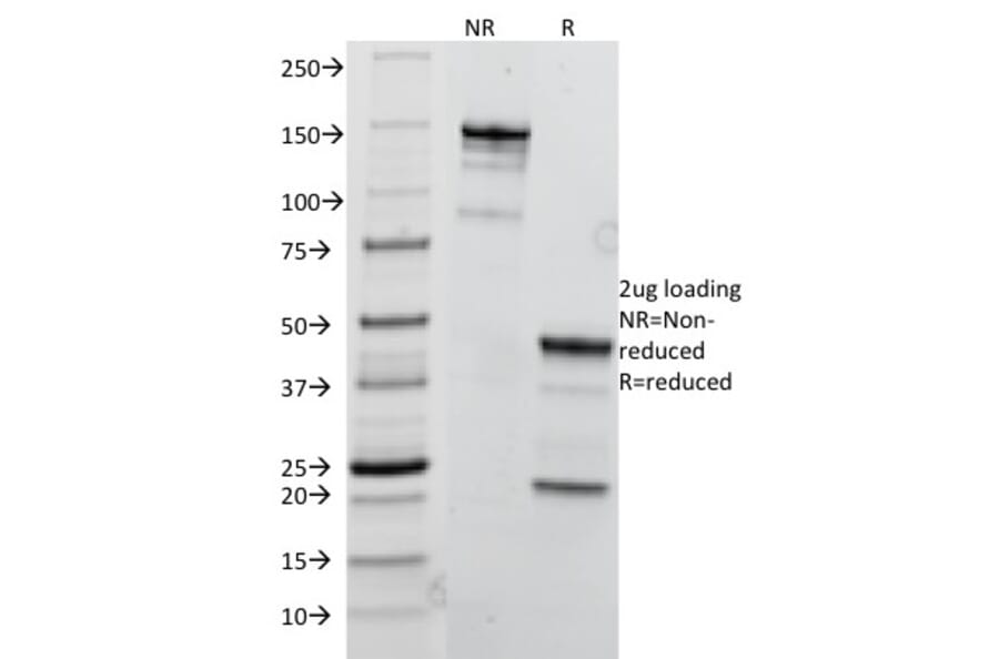 SDS-PAGE - Anti-TRIM29 Antibody [TRIM29/1041] - BSA and Azide free (A251802) - Antibodies.com