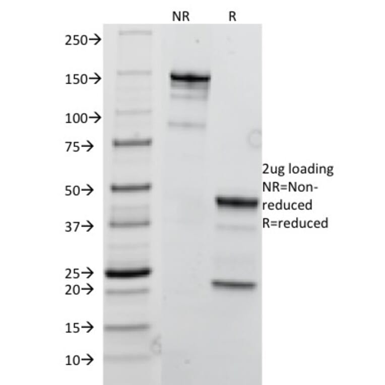 SDS-PAGE - Anti-TRIM29 Antibody [TRIM29/1041] - BSA and Azide free (A251802) - Antibodies.com