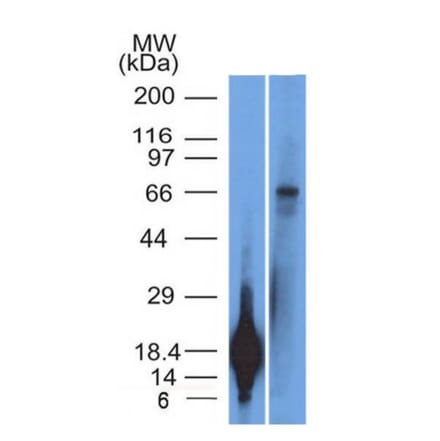 Western Blot - Anti-TRIM29 Antibody [TRIM29/1042] - BSA and Azide free (A251803) - Antibodies.com