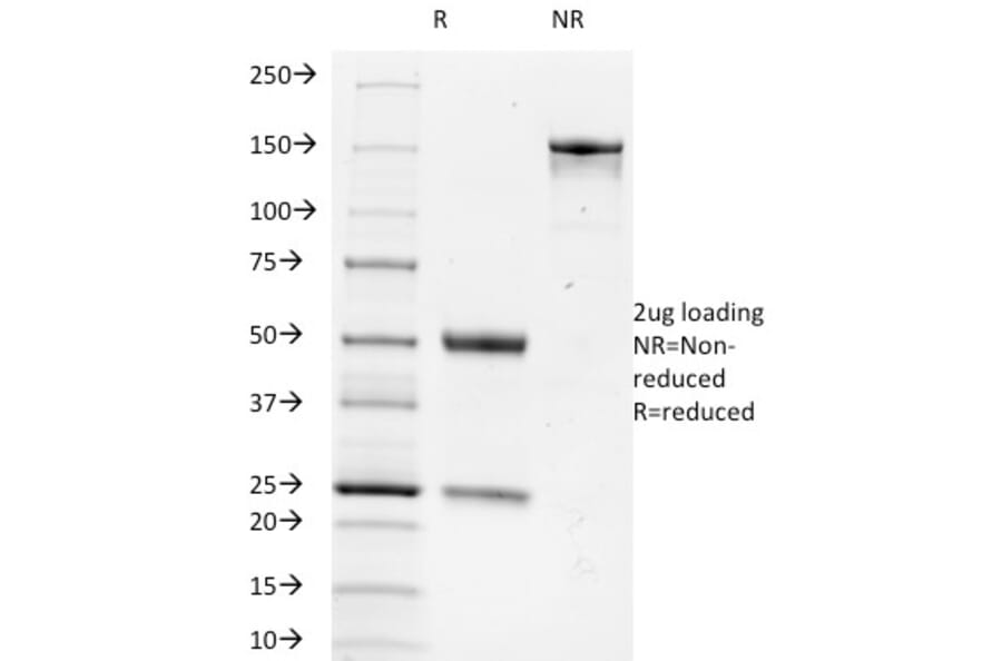SDS-PAGE - Anti-TRIM29 Antibody [TRIM29/1042] - BSA and Azide free (A251802) - Antibodies.com