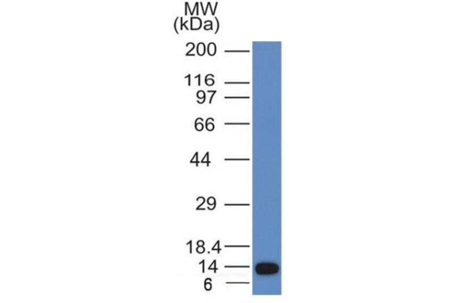 Western Blot - Anti-ALK Antibody [ALK/1031] - BSA and Azide free (A251803) - Antibodies.com