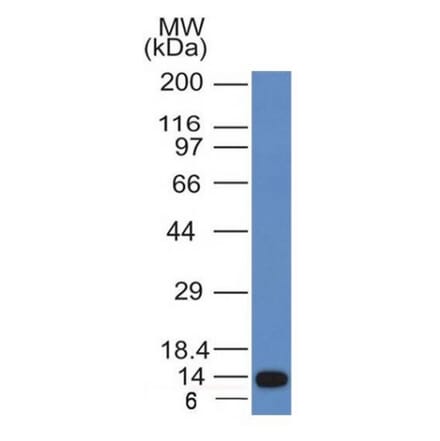 Western Blot - Anti-ALK Antibody [ALK/1031] - BSA and Azide free (A251803) - Antibodies.com
