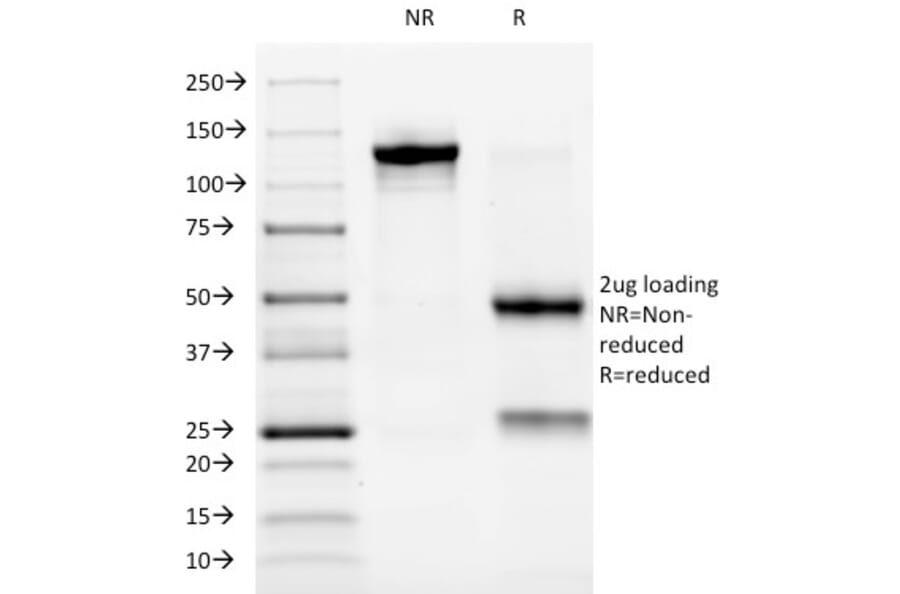 SDS-PAGE - Anti-ALK Antibody [ALK/1032] - BSA and Azide free (A251804) - Antibodies.com