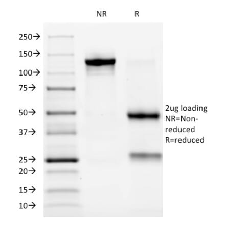 SDS-PAGE - Anti-ALK Antibody [ALK/1032] - BSA and Azide free (A251804) - Antibodies.com