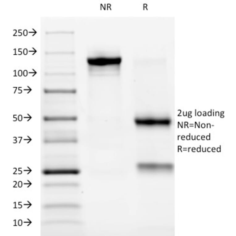 SDS-PAGE - Anti-ALK Antibody [ALK/1032] - BSA and Azide free (A251804) - Antibodies.com