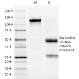 SDS-PAGE - Anti-ALK Antibody [ALK/1032] - BSA and Azide free (A251804) - Antibodies.com