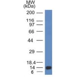 Western Blot - Anti-ALK Antibody [ALK/1032] - BSA and Azide free (A251805) - Antibodies.com