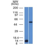 Western Blot - Anti-ALK Antibody [ALK/1503] - BSA and Azide free (A251805) - Antibodies.com