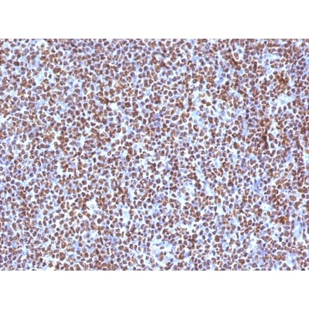 Immunohistochemistry - Anti-ALK Antibody [ALK/1504] - BSA and Azide free (A251806) - Antibodies.com
