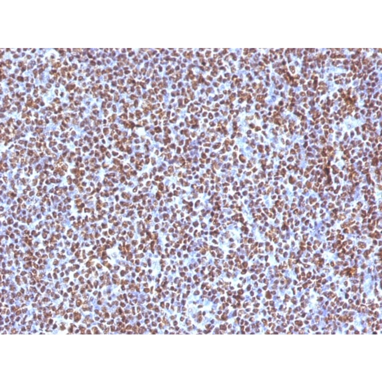 Immunohistochemistry - Anti-ALK Antibody [ALK/1504] - BSA and Azide free (A251806) - Antibodies.com