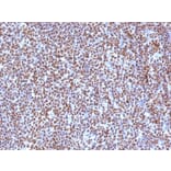 Immunohistochemistry - Anti-ALK Antibody [ALK/1504] - BSA and Azide free (A251806) - Antibodies.com