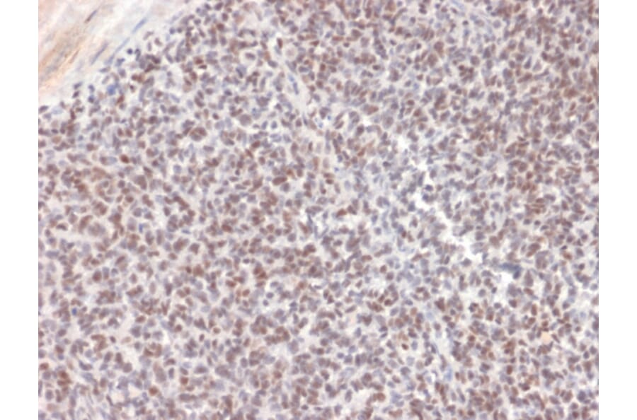 Immunohistochemistry - Anti-ALK Antibody [ALK/1504] - BSA and Azide free (A251807) - Antibodies.com