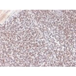 Immunohistochemistry - Anti-ALK Antibody [ALK/1504] - BSA and Azide free (A251807) - Antibodies.com