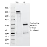 SDS-PAGE - Anti-ALK Antibody [ALK/1504] - BSA and Azide free (A251807) - Antibodies.com