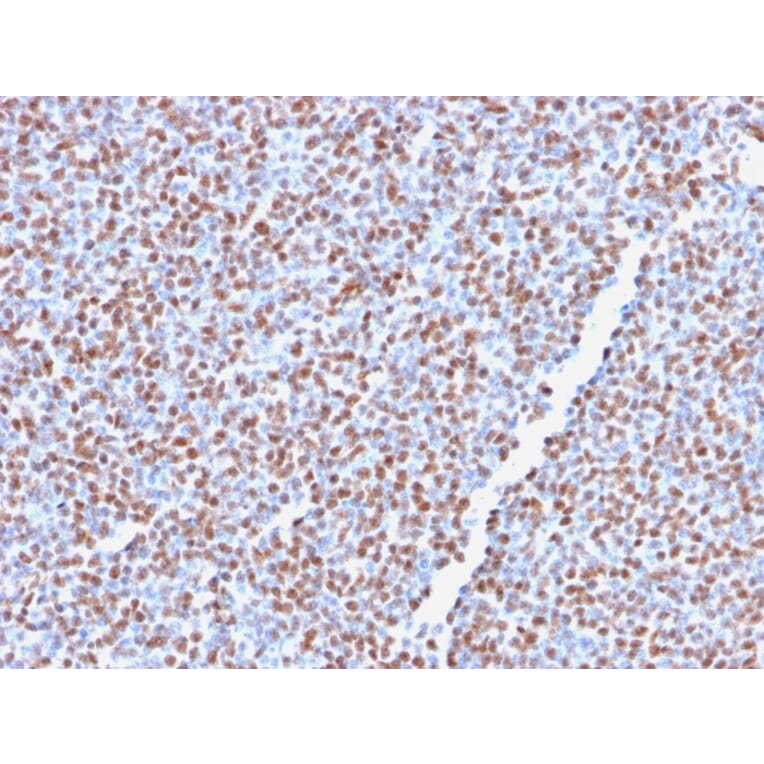 Immunohistochemistry - Anti-ALK Antibody [ALK1/2766R] - BSA and Azide free (A251807) - Antibodies.com