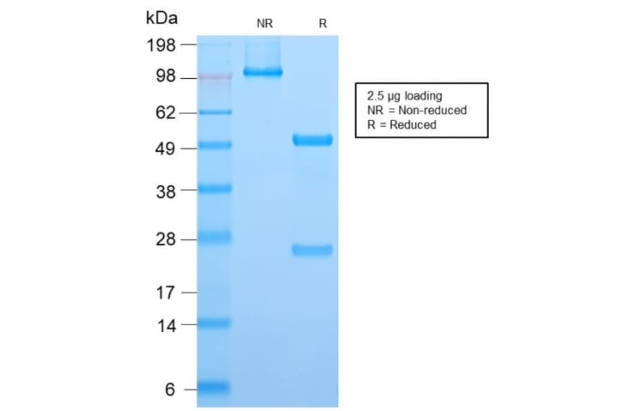 SDS-PAGE - Anti-ALK Antibody [ALK1/2766R] - BSA and Azide free (A251808) - Antibodies.com