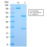 SDS-PAGE - Anti-ALK Antibody [ALK1/2766R] - BSA and Azide free (A251808) - Antibodies.com