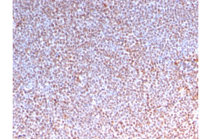 Immunohistochemistry - Anti-ALK Antibody [ALK/3218R] - BSA and Azide free (A251808) - Antibodies.com