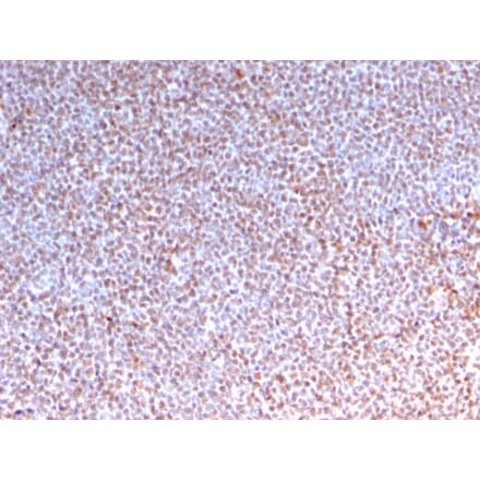 Immunohistochemistry - Anti-ALK Antibody [ALK/3218R] - BSA and Azide free (A251808) - Antibodies.com