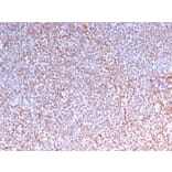 Immunohistochemistry - Anti-ALK Antibody [ALK/3218R] - BSA and Azide free (A251808) - Antibodies.com