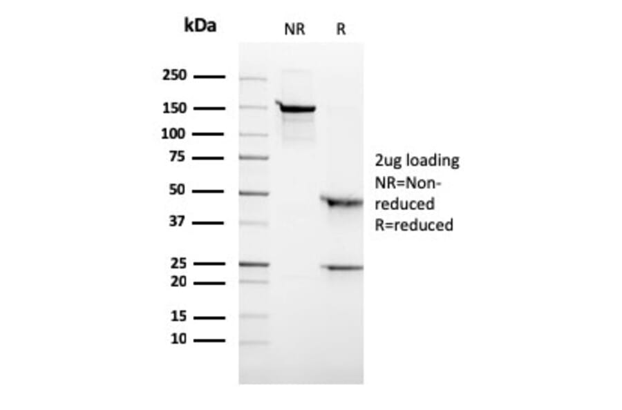 SDS-PAGE - Anti-ALK Antibody [ALK/3218R] - BSA and Azide free (A251809) - Antibodies.com