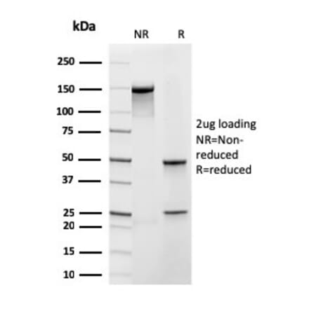 SDS-PAGE - Anti-Frataxin Antibody [rFXN/2124] - BSA and Azide free (A251810) - Antibodies.com