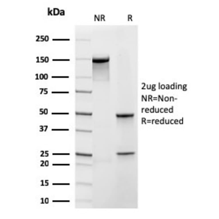 SDS-PAGE - Anti-Frataxin Antibody [rFXN/2124] - BSA and Azide free (A251810) - Antibodies.com