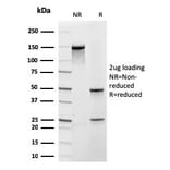 SDS-PAGE - Anti-Frataxin Antibody [rFXN/2124] - BSA and Azide free (A251810) - Antibodies.com