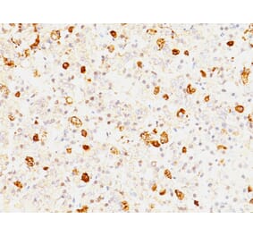 Immunohistochemistry - Anti-FSH beta Antibody [FSHb/1062] - BSA and Azide free (A251811) - Antibodies.com