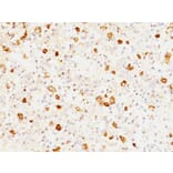 Immunohistochemistry - Anti-FSH beta Antibody [FSHb/1062] - BSA and Azide free (A251811) - Antibodies.com