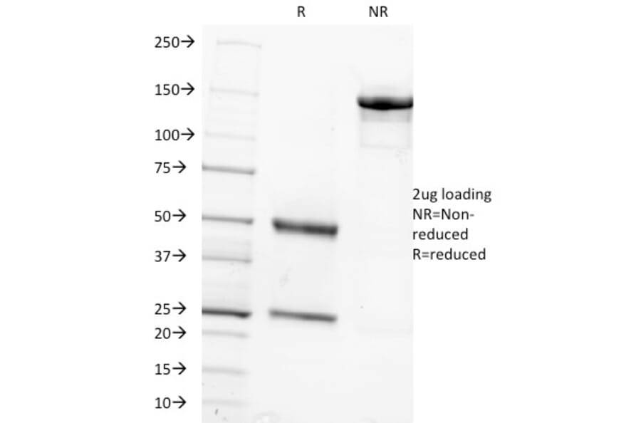 SDS-PAGE - Anti-FSH beta Antibody [FSHb/1062] - BSA and Azide free (A251812) - Antibodies.com