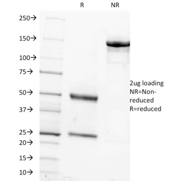 SDS-PAGE - Anti-FSH beta Antibody [FSHb/1062] - BSA and Azide free (A251812) - Antibodies.com