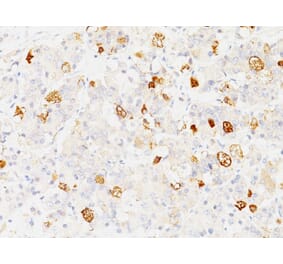 Immunohistochemistry - Anti-FSH beta Antibody [SPM107] - BSA and Azide free (A251812) - Antibodies.com