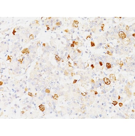 Immunohistochemistry - Anti-FSH beta Antibody [SPM107] - BSA and Azide free (A251812) - Antibodies.com