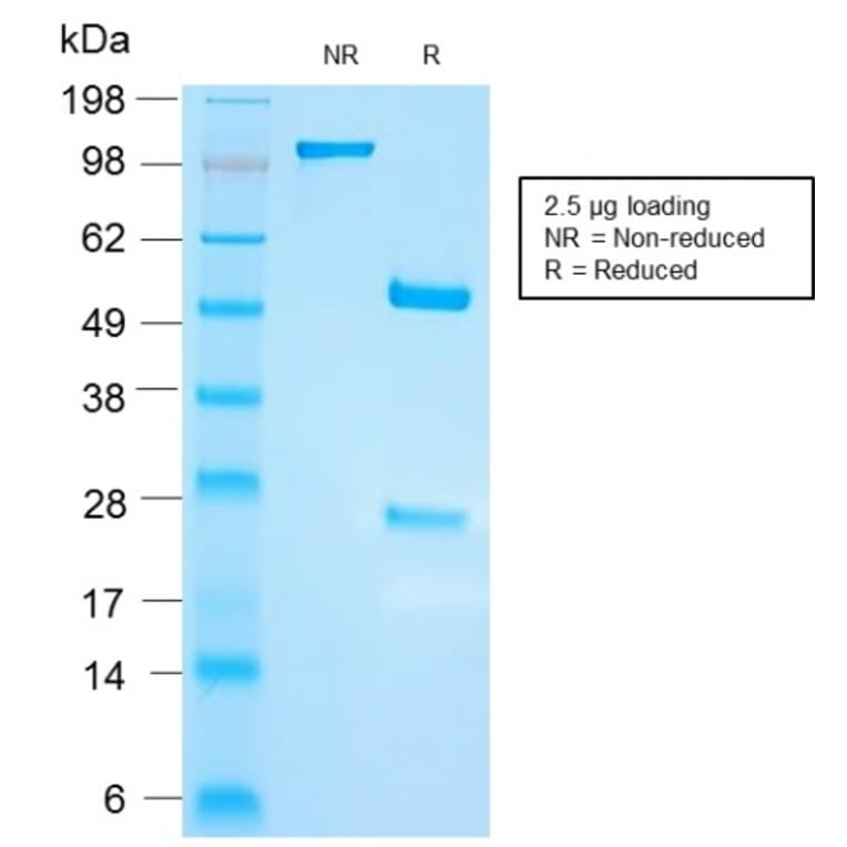 SDS-PAGE - Anti-FSH beta Antibody [FSHb/2033R] - BSA and Azide free (A251814) - Antibodies.com