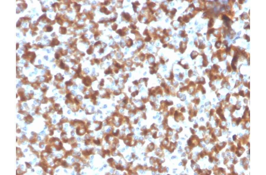 Immunohistochemistry - Anti-FSH beta Antibody [FSHb/2033R] - BSA and Azide free (A251813) - Antibodies.com