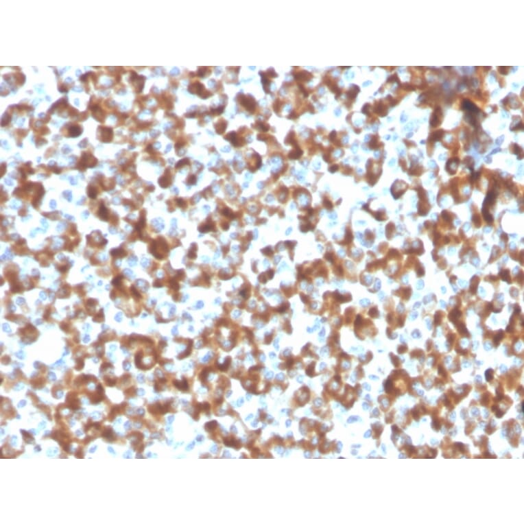 Immunohistochemistry - Anti-FSH beta Antibody [FSHb/2033R] - BSA and Azide free (A251813) - Antibodies.com