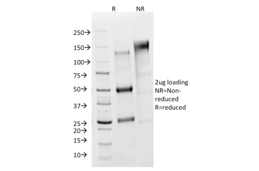 SDS-PAGE - Anti-FSH Receptor Antibody [FSHR/1400] - BSA and Azide free (A251815) - Antibodies.com