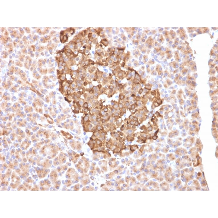 Immunohistochemistry - Anti-Ferritin Heavy Chain Antibody [FTH/2081] - BSA and Azide free (A251816) - Antibodies.com