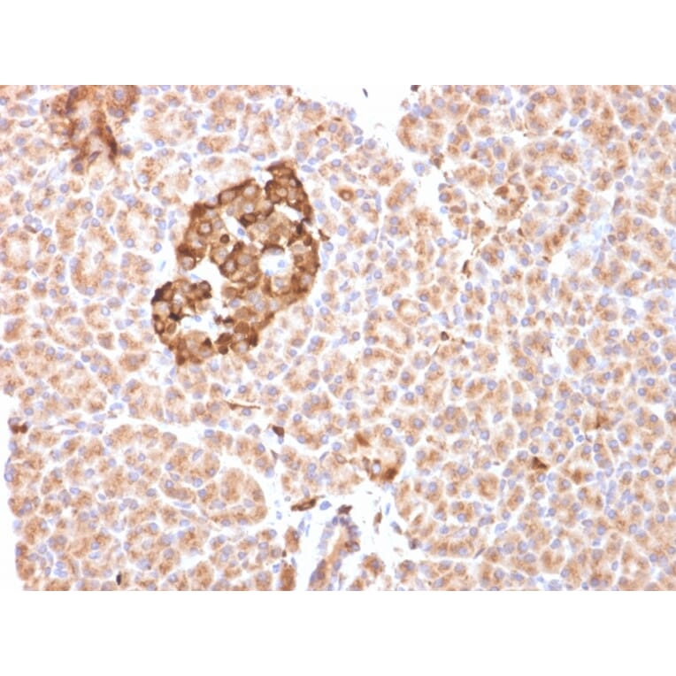 Immunohistochemistry - Anti-Ferritin Heavy Chain Antibody [FTH/2081] - BSA and Azide free (A251815) - Antibodies.com