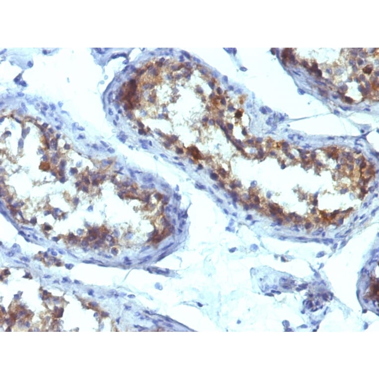 Immunohistochemistry - Anti-Alkaline Phosphatase, Tissue Non-Specific Antibody [ALPL/597] - BSA and Azide free (A251818) - Antibodies.com