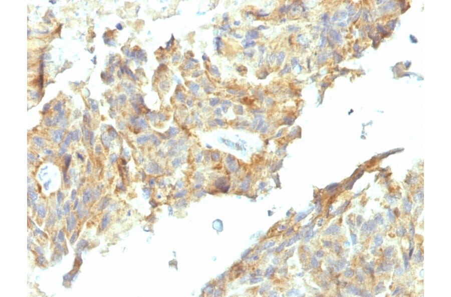 Immunohistochemistry - Anti-Alkaline Phosphatase, Tissue Non-Specific Antibody [ALPL/597] - BSA and Azide free (A251818) - Antibodies.com