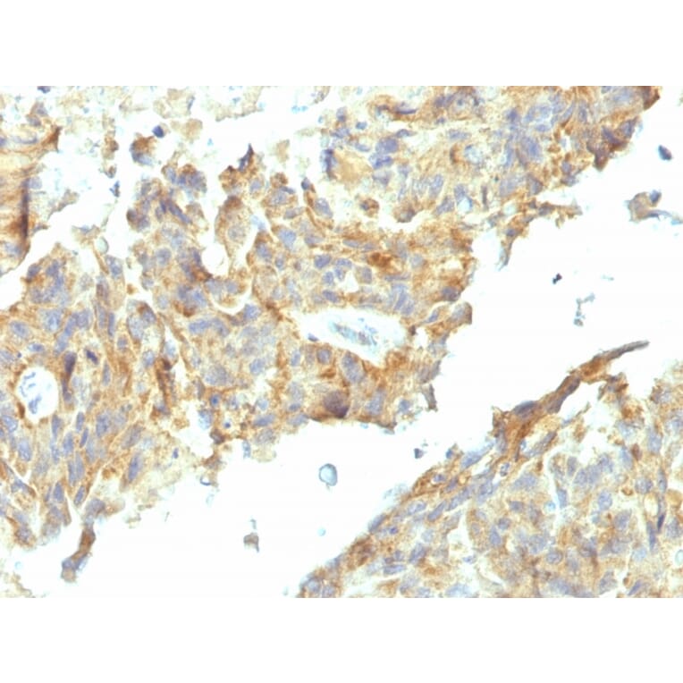 Immunohistochemistry - Anti-Alkaline Phosphatase, Tissue Non-Specific Antibody [ALPL/597] - BSA and Azide free (A251818) - Antibodies.com